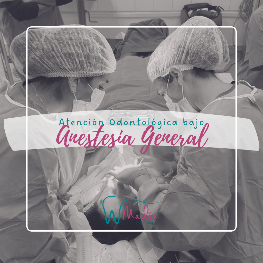 ANESTESIA GENERAL